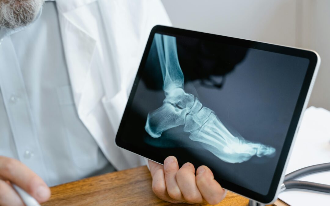 Because Strong Bones Matter